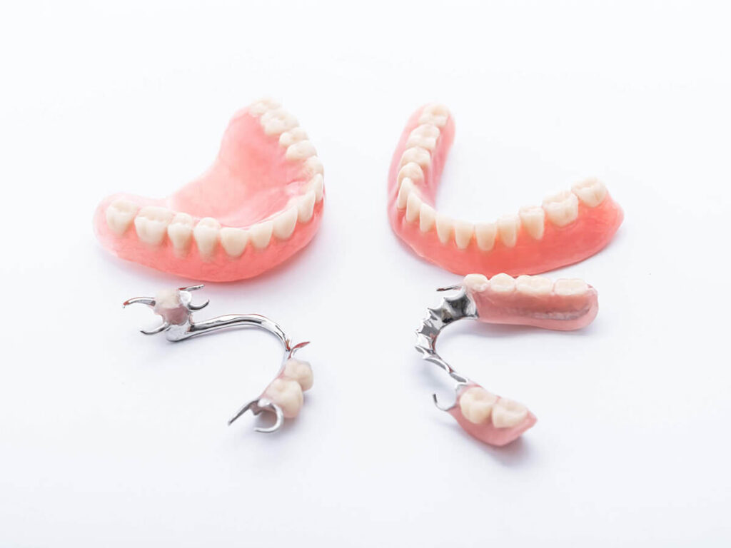 The image shows two full sets of dentures, one for the upper and one for the lower jaw, with pink gum-like bases and white artificial teeth. Additionally, there are two partial dentures with metal clasps and a few artificial teeth attached to pink gum-like bases.